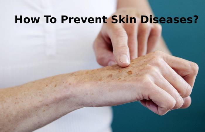 How To Prevent Skin Diseases_
