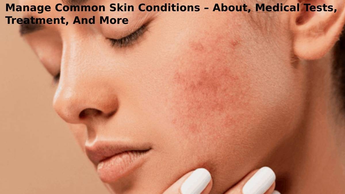 Manage Common Skin Conditions – About, Medical Tests, Treatment, And More