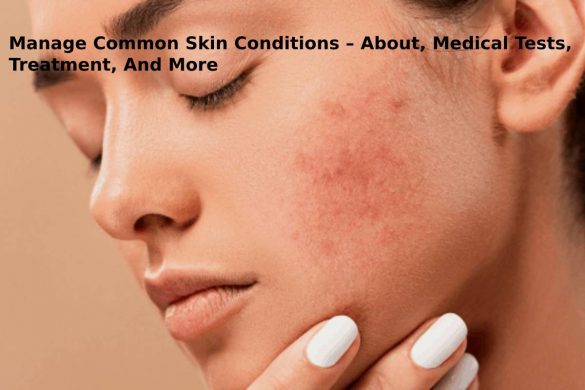 Manage Common Skin Conditions
