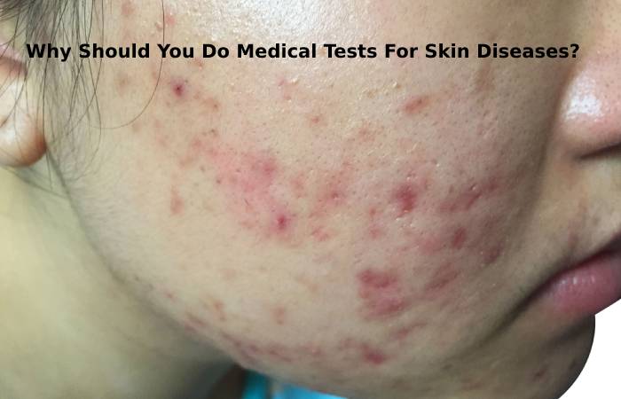 Manage Why Should You Do Medical Tests For Skin Diseases_Skin Conditions