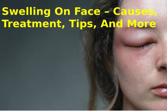 Swelling On Face