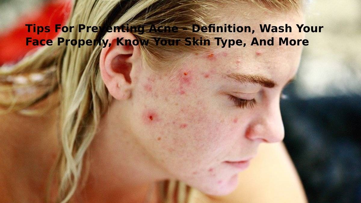 Tips For Preventing Acne – Definition, Wash Your Face Properly, Know Your Skin Type, And More