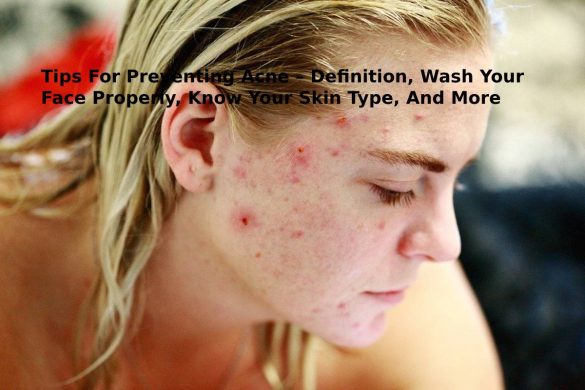 Tips For Preventing Acne