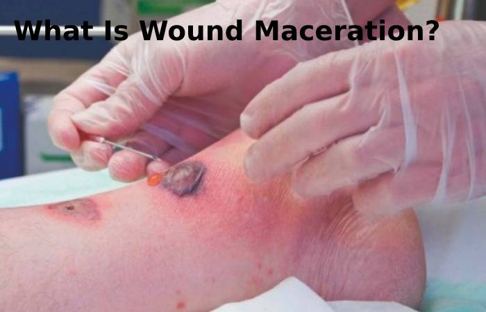 What Is Wound Maceration_