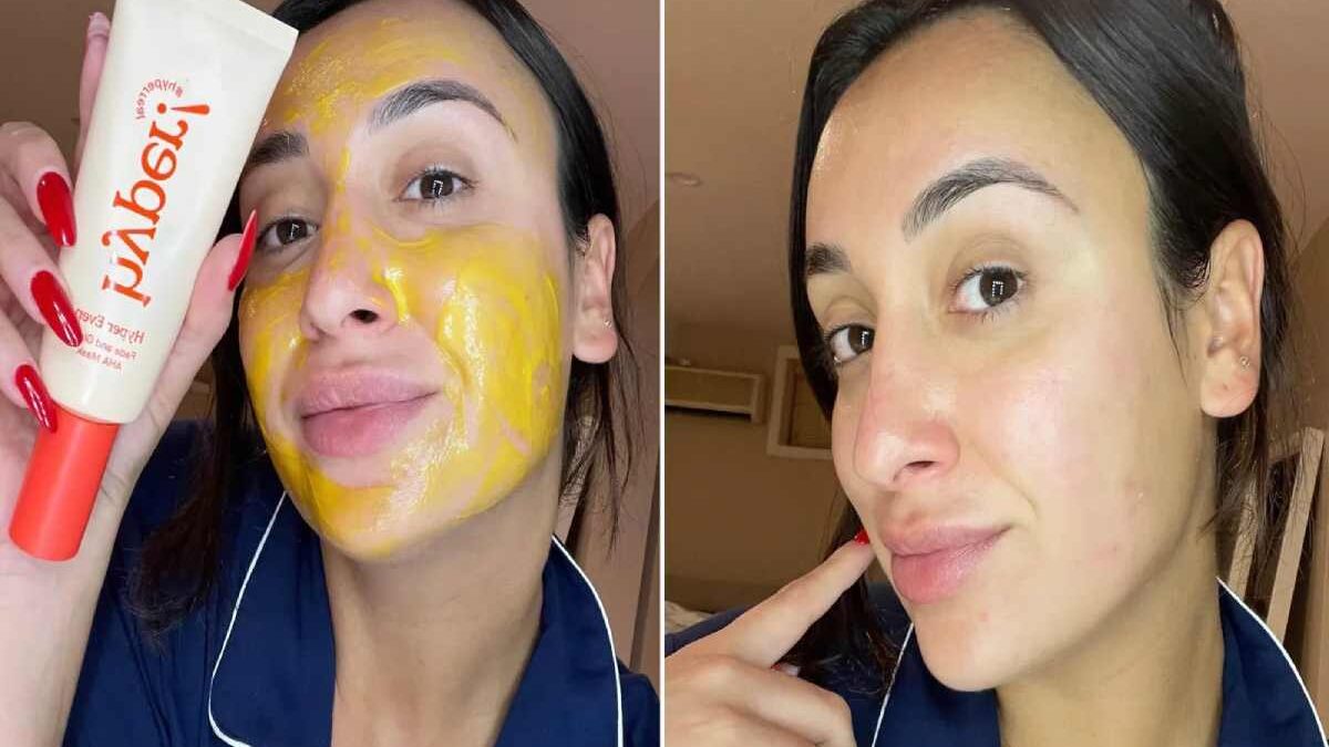 Hyper Skin: About, Dark Spots, Glow AHA Mask, And More